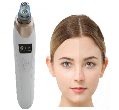 Luxury blackhead remover vacuum for deep pore cleansing