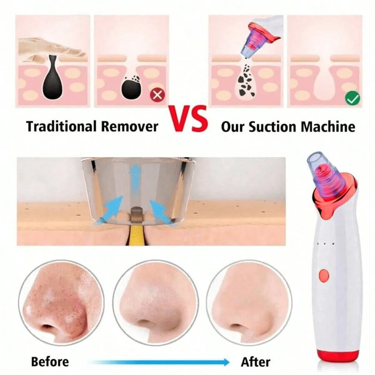 PurePore™ Visual Blackhead Vacuum